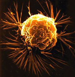 Cellule cancereuse