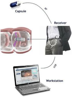 La coloscopie virtuelle aussi efficace que la traditionnelle Check-cap-3_00FA000001216771