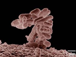 E_coli_at_10000x