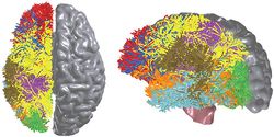 IBM cerveau